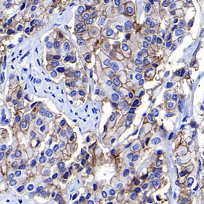 STEAP1+STEAP1B1+STEAP1B2 Recombinant Rabbit mAb (S-3226-137)