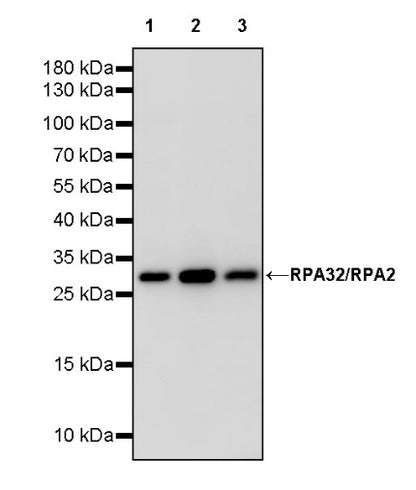 RPA32/RPA2 Rabbit Polyclonal Antibody