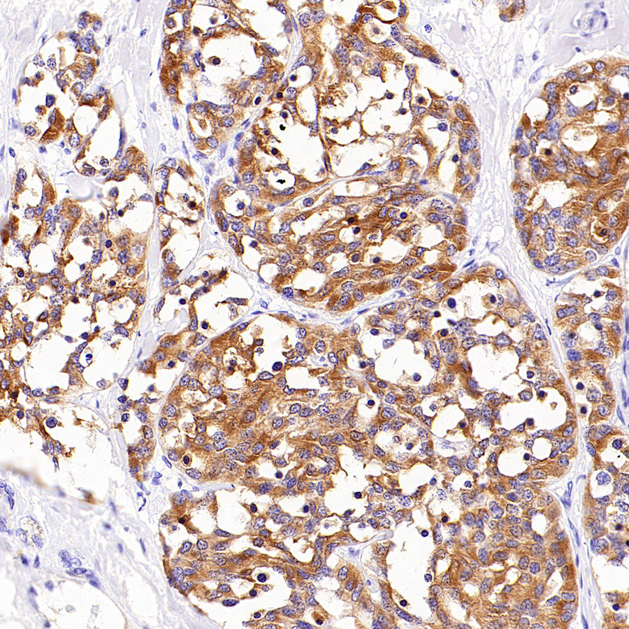 PAM Recombinant Rabbit mAb (SDT-2995-30)
