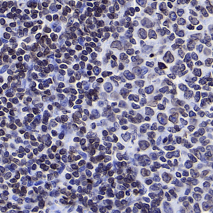 Lamin B1 Recombinant Mouse mAb (S-4865)