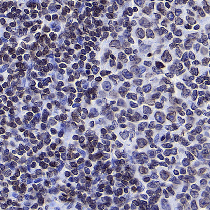 Lamin B1 Recombinant Mouse mAb (S-4865)