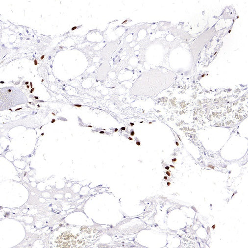 Sp7/Osterix Recombinant Rabbit mAb (SDT-3238-16)