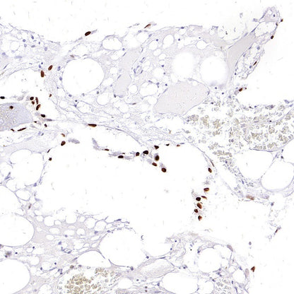 Sp7/Osterix Recombinant Rabbit mAb (SDT-3238-16)