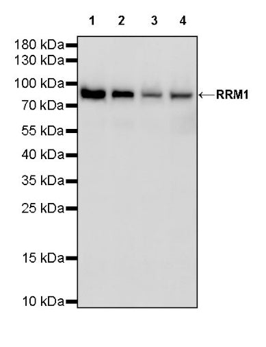 RRM1 Recombinant Rabbit mAb (S-587-21)
