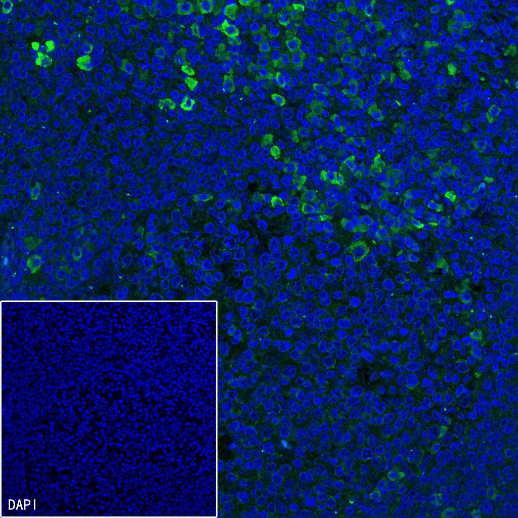 CD10 Recombinant Rabbit mAb (SDT-006-77)