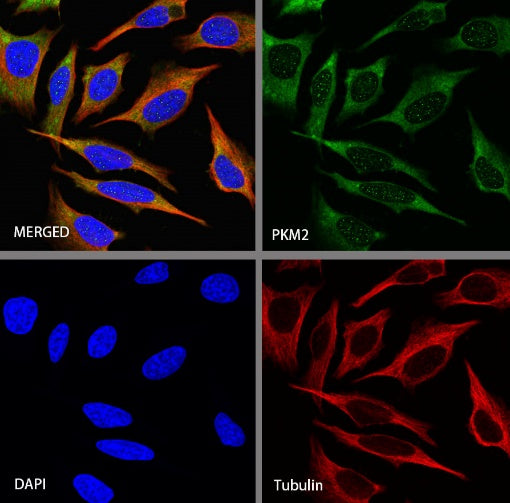 PKM2 Rabbit Polyclonal antibody