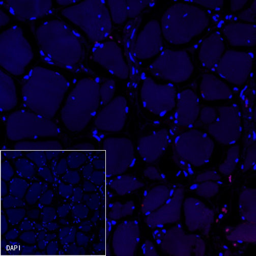 CD79a/MB-1 Recombinant Rabbit mAb (Alexa Fluor® 594 Conjugate) (S-030-18)