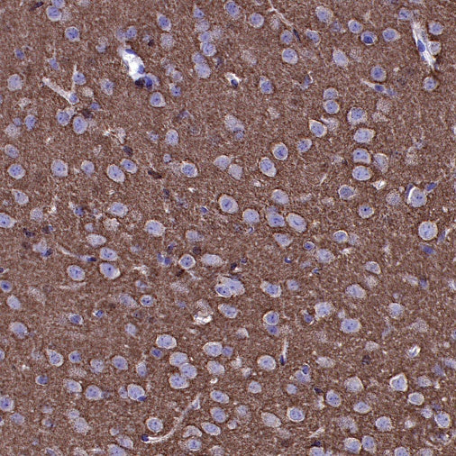 VAMP2 Recombinant Rabbit mAb (S-2359-2)