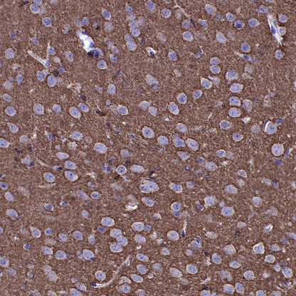VAMP2 Recombinant Rabbit mAb (S-2359-2)