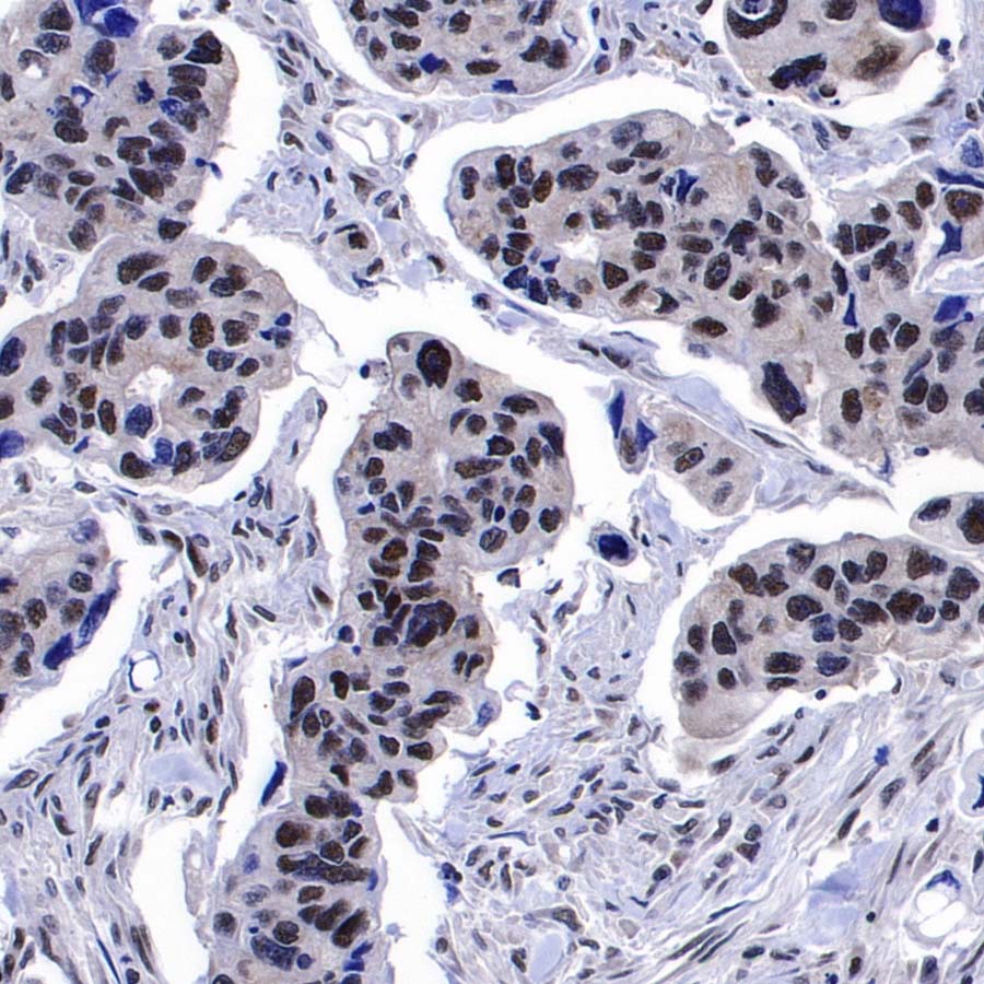 DDX39B Recombinant Rabbit mAb (S-4549-30)