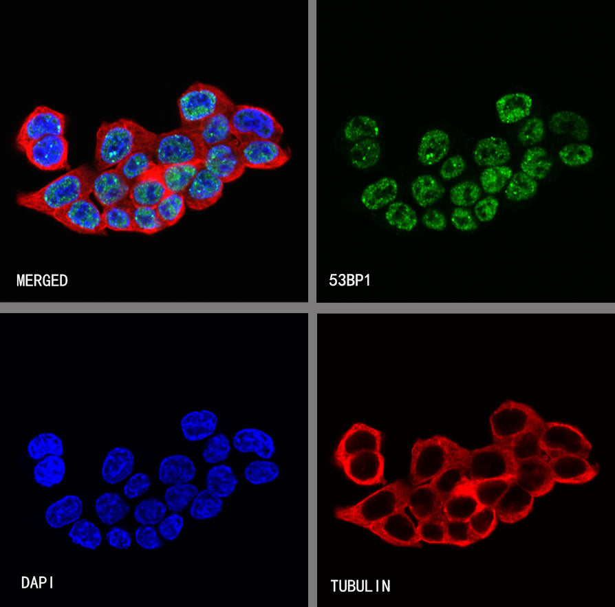 53BP1 Recombinant Rabbit mAb (S-3170-149)