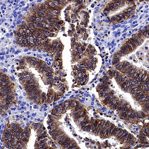 S-RMab® EpCAM Recombinant Rabbit mAb (SDT-078-128)