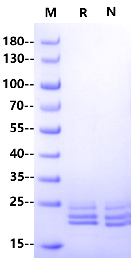 IL-11 His Tag Protein, Cynomolgus