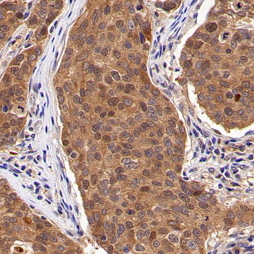 AMPK α1 Rabbit Polyclonal Antibody