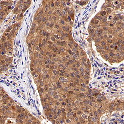AMPK α1 Rabbit Polyclonal Antibody