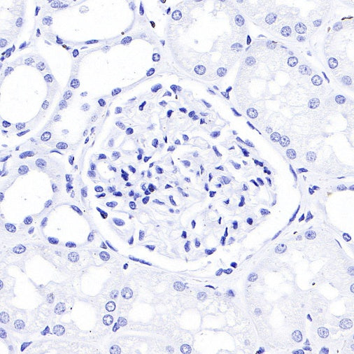 TFF1 Recombinant Rabbit mAb (S-336-75)