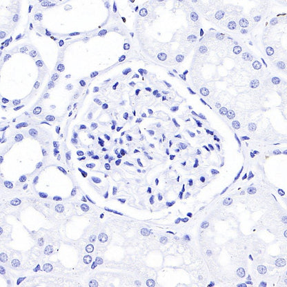 TFF1 Recombinant Rabbit mAb (S-336-75)