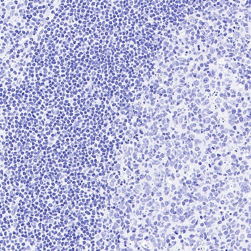 Pan Trk Recombinant Rabbit mAb (SDT-400-39)