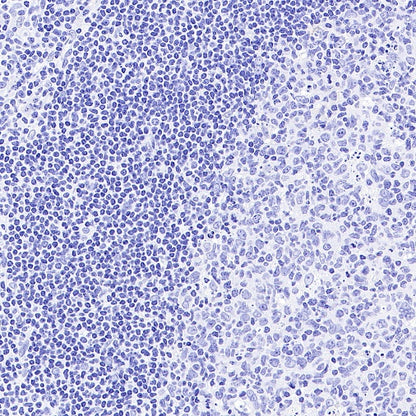 Pan Trk Recombinant Rabbit mAb (SDT-400-39)