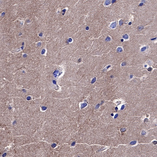 PKC alpha Recombinant Rabbit mAb (S-624-36)