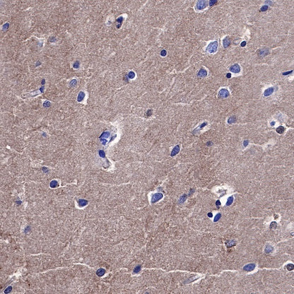 PKC alpha Recombinant Rabbit mAb (S-624-36)