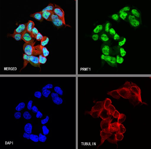 PRMT1 Recombinant Rabbit mAb (S-884-10)