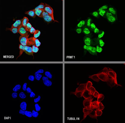 PRMT1 Recombinant Rabbit mAb (S-884-10)
