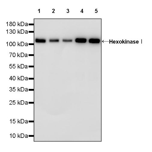 HexokinaseⅠRecombinant Rabbit mAb (S-868-113)