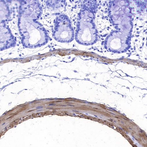 Calponin-1 Recombinant Rabbit mAb (S-R161)