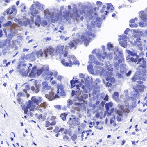 S-RMab®SALL4 Recombinant Rabbit mAb (SDT-R232)