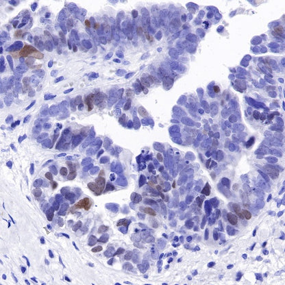S-RMab®SALL4 Recombinant Rabbit mAb (SDT-R232)