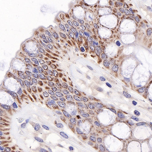 MTAP Recombinant Rabbit mAb (S-813-23)