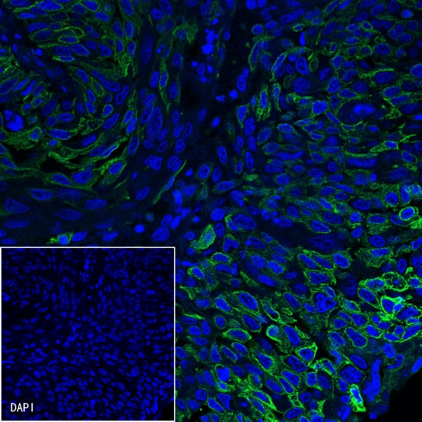B7-H3 Recombinant Rabbit mAb (SDT-249-26)