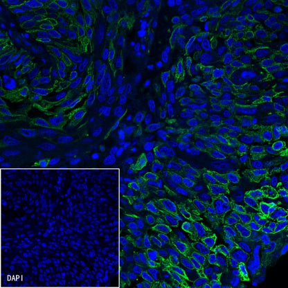 B7-H3 Recombinant Rabbit mAb (SDT-249-26)