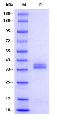 ApoE3 His Tag Protein, Human