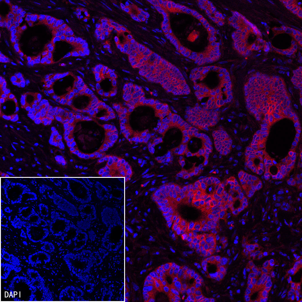 EpCAM Recombinant Rabbit mAb (PE Conjugate) (S-078-128)