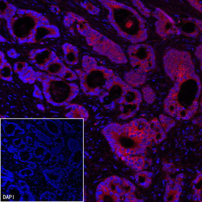 EpCAM Recombinant Rabbit mAb (PE Conjugate) (S-078-128)