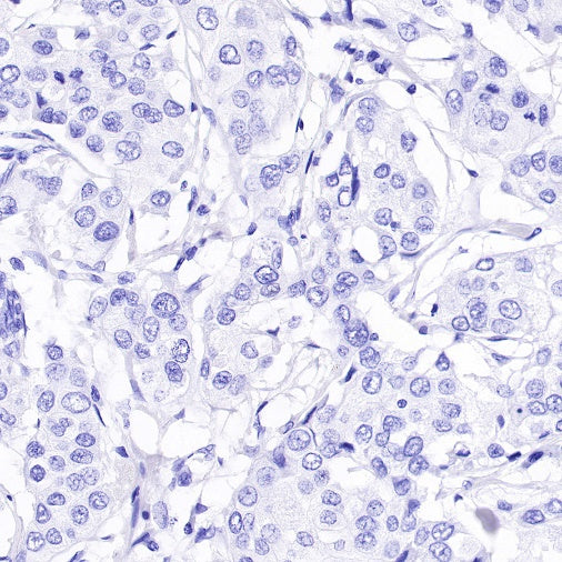 Estrogen Receptor α Recombinant Rabbit mAb (SDT-10001)