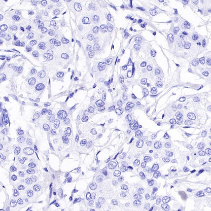 Estrogen Receptor α Recombinant Rabbit mAb (SDT-10001)