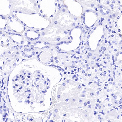 Spink1 Recombinant Rabbit mAb (S-R249)