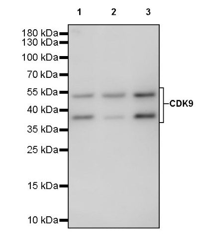 CDK9 Rabbit Polyclonal Antibody