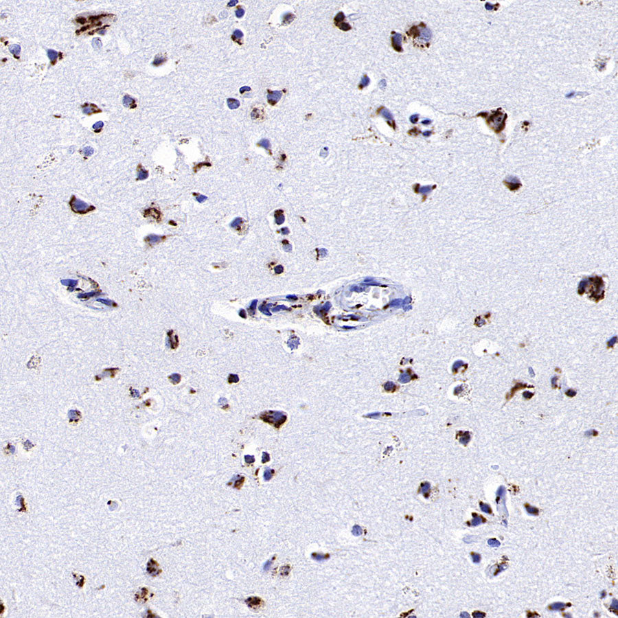 TGN46 Recombinant Rabbit mAb (S-3514-47)