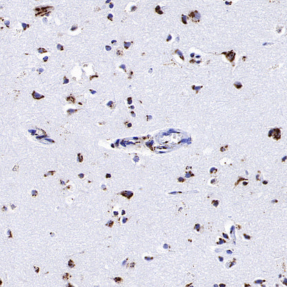 TGN46 Recombinant Rabbit mAb (S-3514-47)
