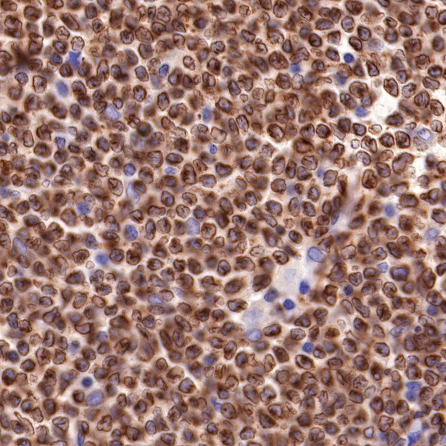 S-RMab® Bcl-2 Recombinant Rabbit mAb,PBS Only (SDT-R160)