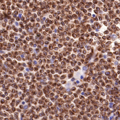 S-RMab® Bcl-2 Recombinant Rabbit mAb,PBS Only (SDT-R160)