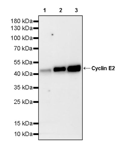 Cyclin E2 Recombinant Rabbit mAb (S-5247)