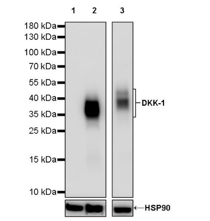 DKK-1 Recombinant Rabbit mAb (S-232-231)
