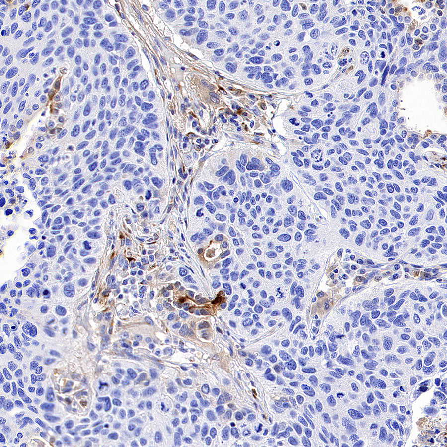 TIMP1 Recombinant Rabbit mAb (S-5147)