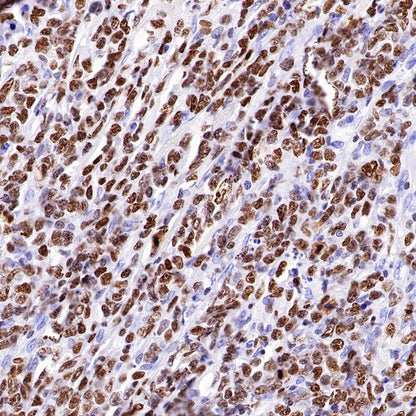 IKAROS Recombinant Rabbit mAb (S-R264)