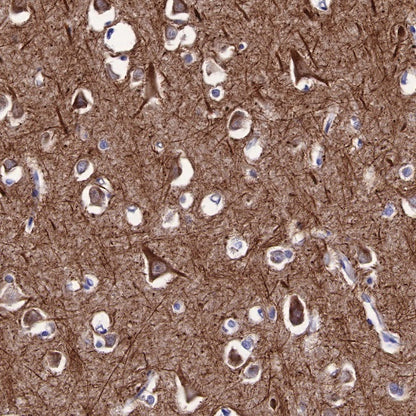 Neurofilament M Recombinant Rabbit mAb (S-501-31)